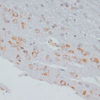 Phospho-CrkL (Tyr207) Antibody in Immunohistochemistry (Paraffin) (IHC (P))