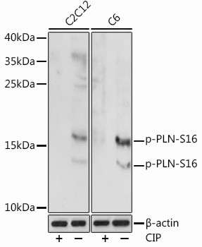 Phospho-Phospholamban (Ser16) Antibody in Western Blot (WB)