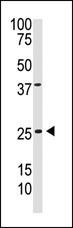 PDGF-B Antibody in Western Blot (WB)