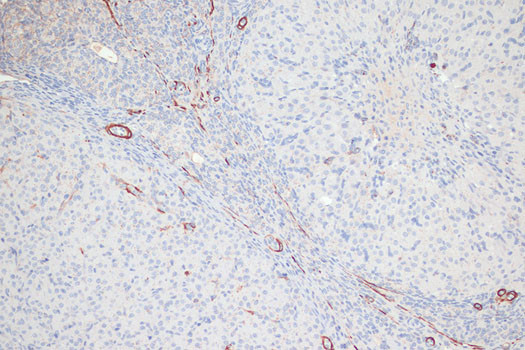 Phospho-MYL9 (Thr18, Ser19) Antibody in Immunohistochemistry (Paraffin) (IHC (P))