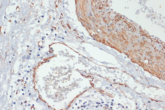 Phospho-MYL9 (Thr18, Ser19) Antibody in Immunohistochemistry (Paraffin) (IHC (P))