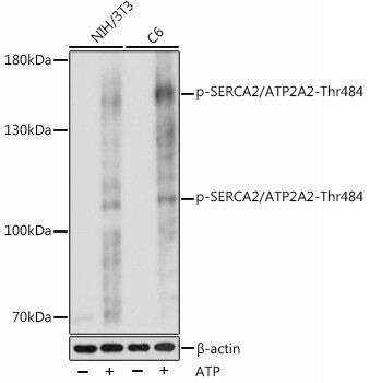 Phospho-SERCA2 ATPase (Thr484) Antibody in Western Blot (WB)