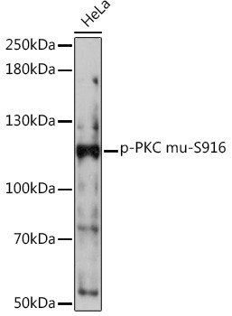 Phospho-PKC mu (Ser916) Antibody in Western Blot (WB)