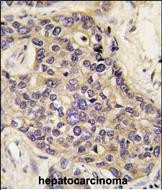 HGF Antibody in Immunohistochemistry (Paraffin) (IHC (P))