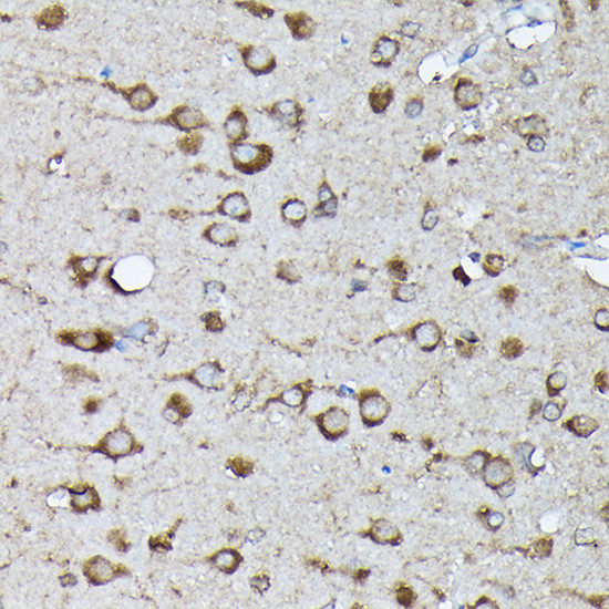 Phospho-K-Ras (Ser89) Antibody in Immunohistochemistry (Paraffin) (IHC (P))