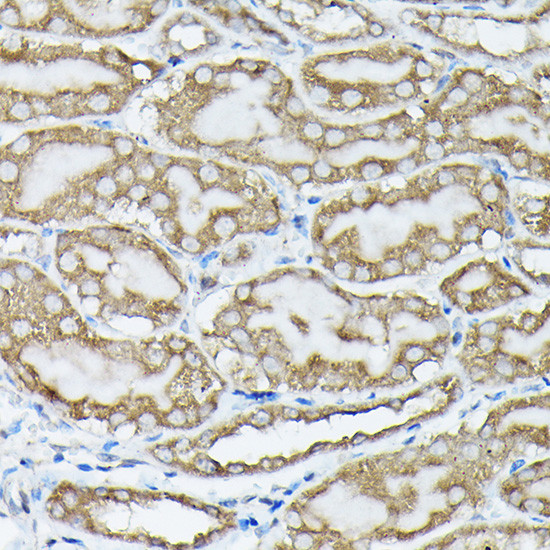 Phospho-K-Ras (Ser89) Antibody in Immunohistochemistry (Paraffin) (IHC (P))