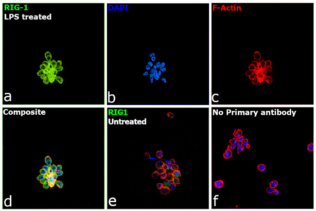 RIG-I Antibody in Immunocytochemistry (ICC/IF)