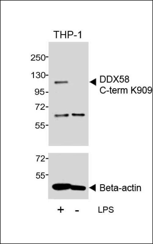 RIG-I Antibody in Western Blot (WB)