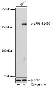 Phospho-LRP6 (Ser1490) Antibody in Western Blot (WB)