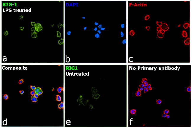 RIG-I Antibody in Immunocytochemistry (ICC/IF)