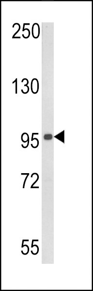 RIG-I Antibody in Western Blot (WB)