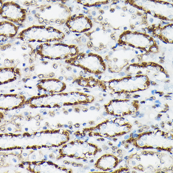 Phospho-FOXO3A (Ser425) Antibody in Immunohistochemistry (Paraffin) (IHC (P))