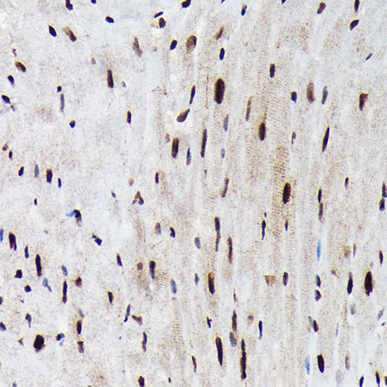 Phospho-FOXO3A (Ser425) Antibody in Immunohistochemistry (Paraffin) (IHC (P))