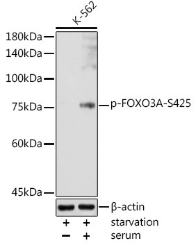 Phospho-FOXO3A (Ser425) Antibody in Western Blot (WB)