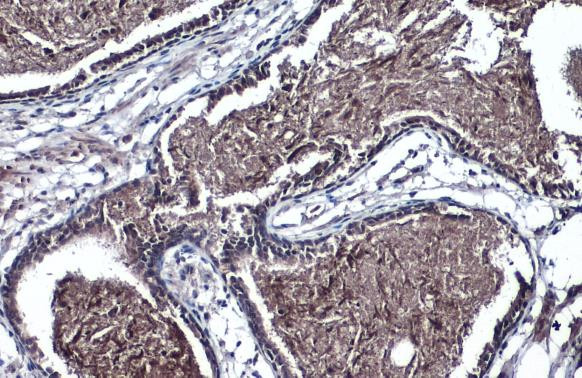 TMPRSS2 Antibody in Immunohistochemistry (Paraffin) (IHC (P))