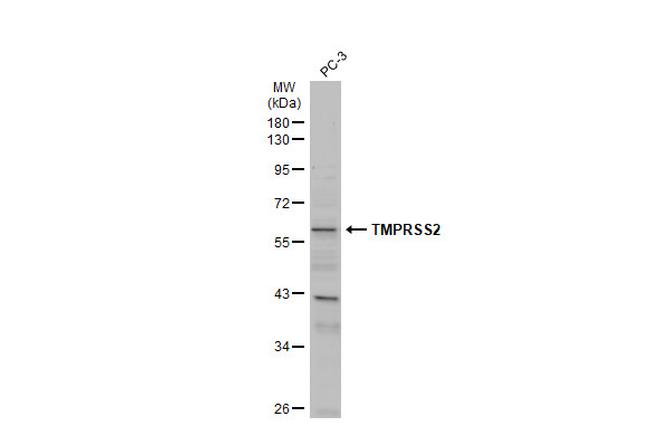 TMPRSS2 Antibody in Western Blot (WB)