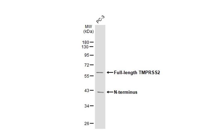 TMPRSS2 Antibody in Western Blot (WB)