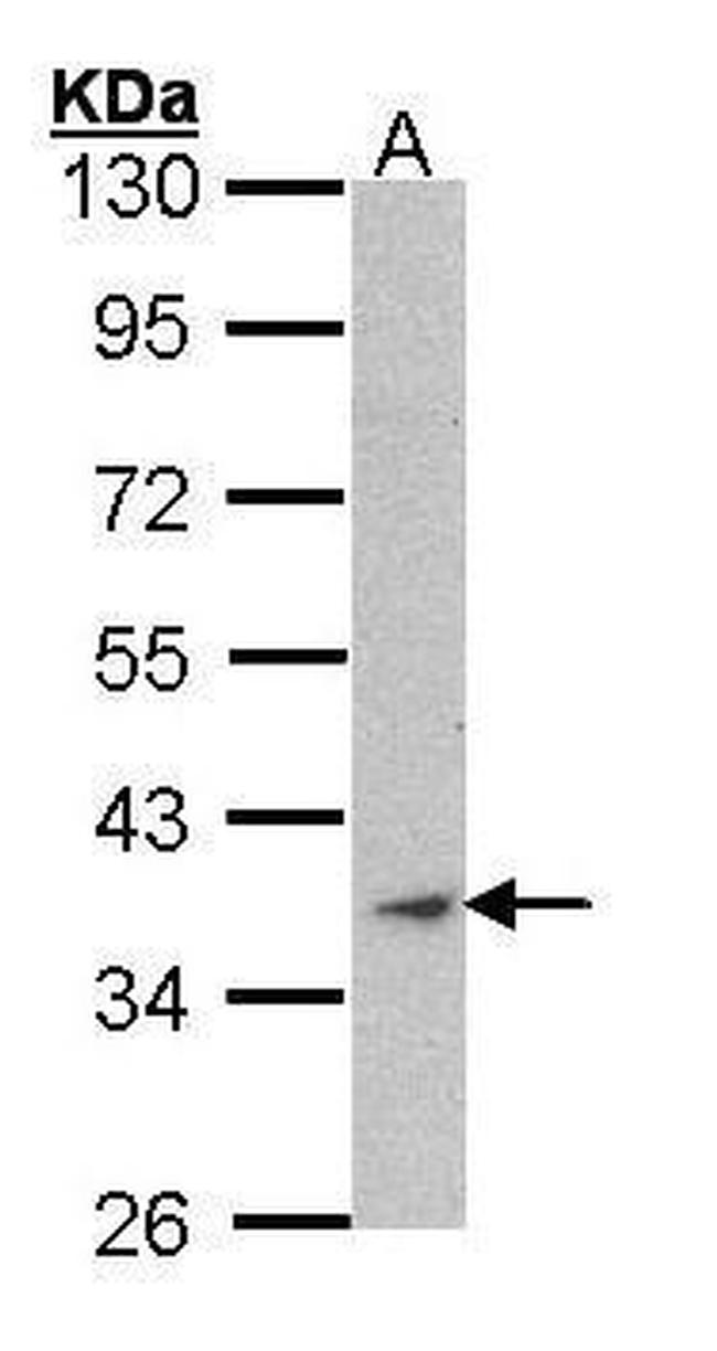 Skeletal Muscle Actin Antibody in Western Blot (WB)