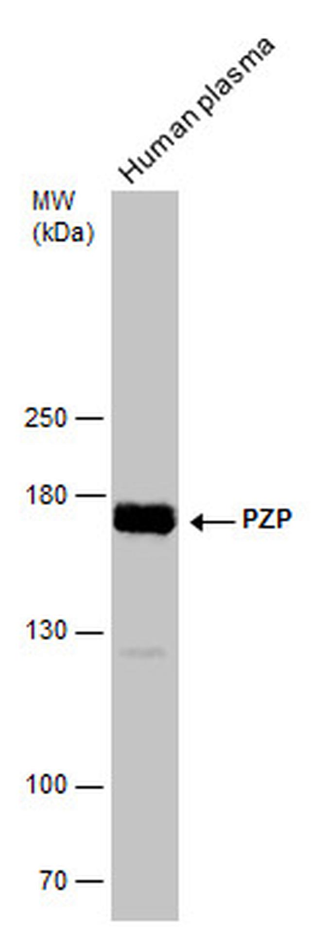 PZP Antibody in Western Blot (WB)