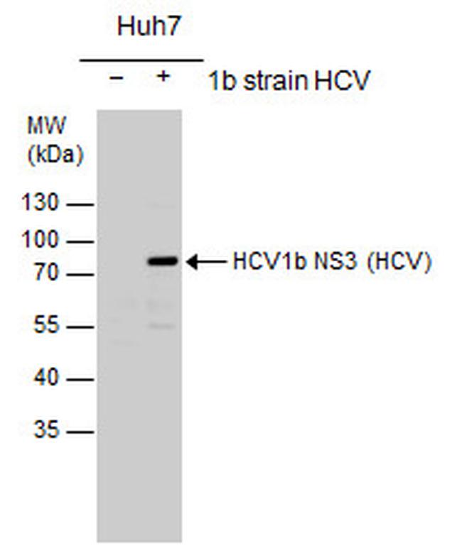 Hepatitis C Virus NS3 Antibody in Western Blot (WB)
