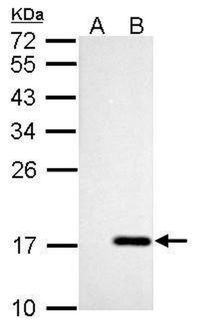 NME4 Antibody in Western Blot (WB)