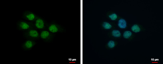 MLK1 Antibody in Immunocytochemistry (ICC/IF)