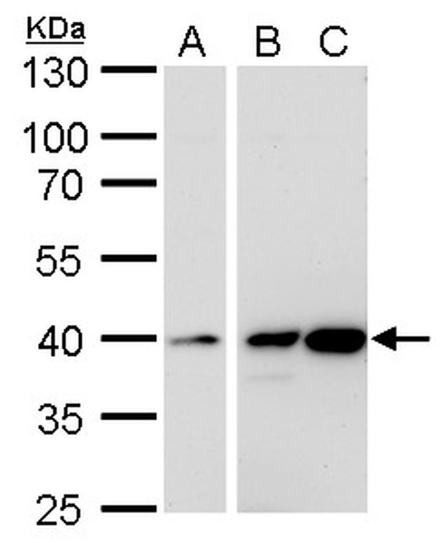 Calponin 3 Antibody in Western Blot (WB)