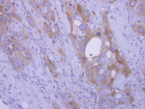 COL4A3BP Antibody in Immunohistochemistry (Paraffin) (IHC (P))