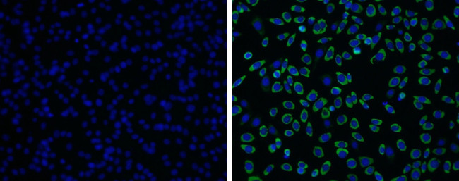 Japanese Encephalitis Virus NS1 Antibody in Immunocytochemistry (ICC/IF)