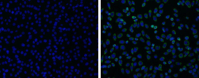 Japanese Encephalitis Virus NS1 Antibody in Immunocytochemistry (ICC/IF)