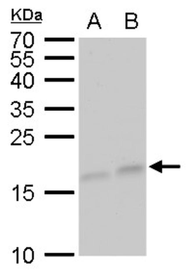 GABARAPL1 Antibody in Western Blot (WB)