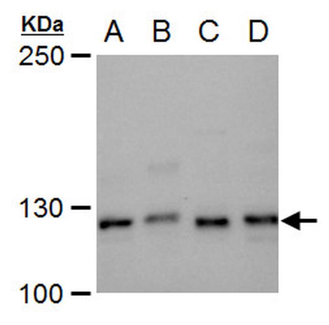 XPF Antibody in Western Blot (WB)