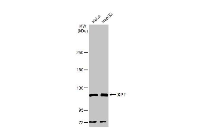 XPF Antibody in Western Blot (WB)