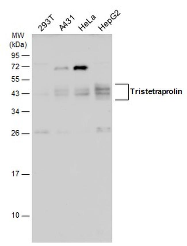 ZFP36 Antibody in Western Blot (WB)