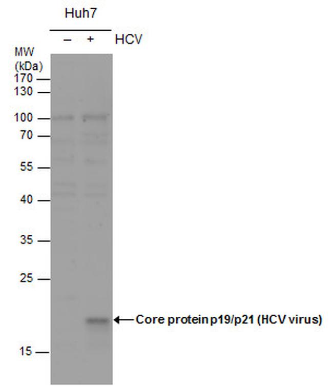 Hepatitis C Virus Core Antigen Antibody in Western Blot (WB)
