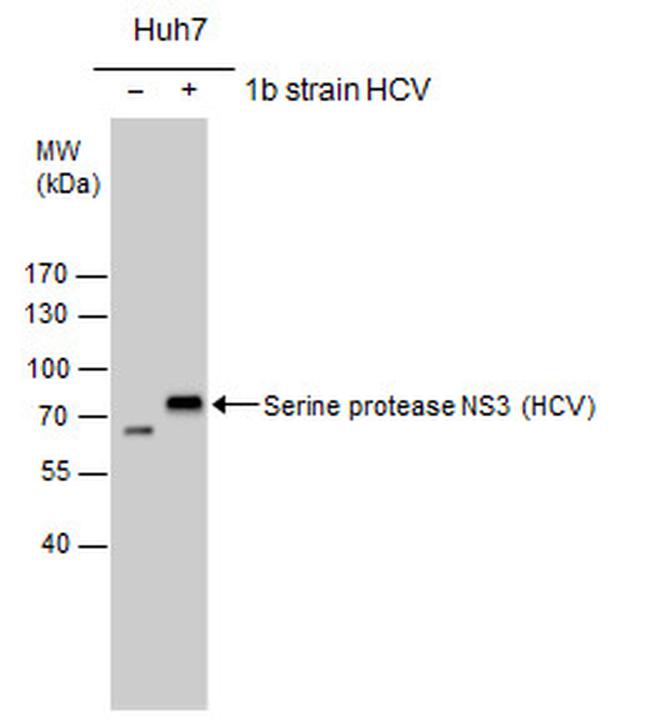 Hepatitis C Virus NS3 Antibody in Western Blot (WB)