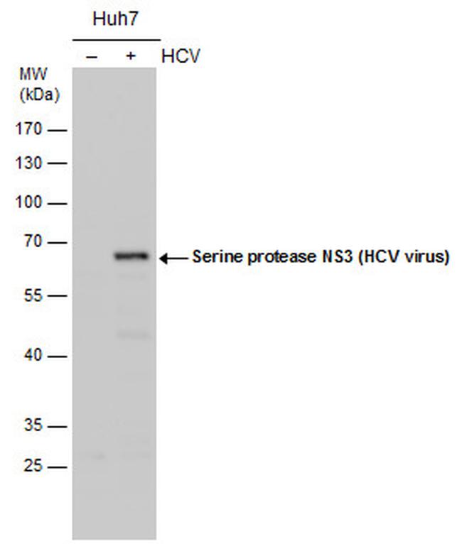 Hepatitis C Virus NS3 Antibody in Western Blot (WB)