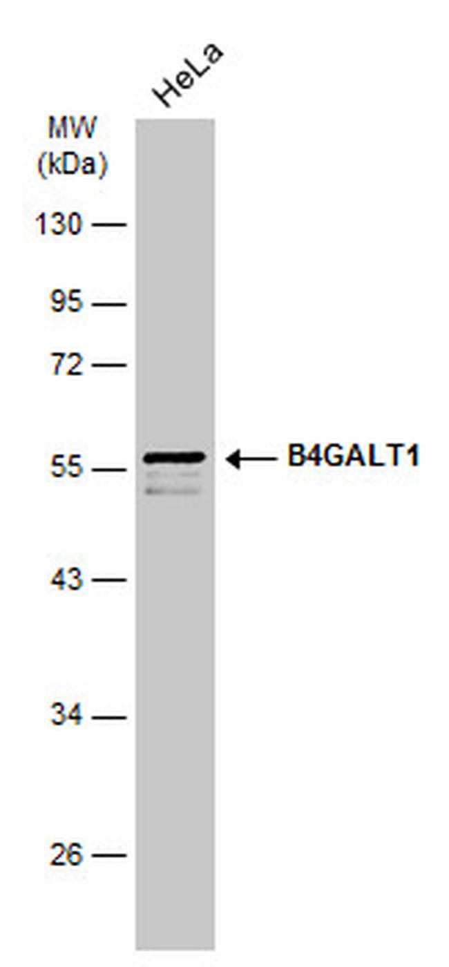 B4GALT1 Antibody in Western Blot (WB)