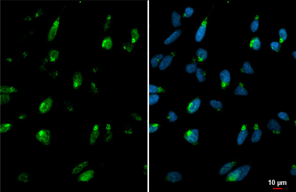 GALNT3 Antibody in Immunocytochemistry (ICC/IF)