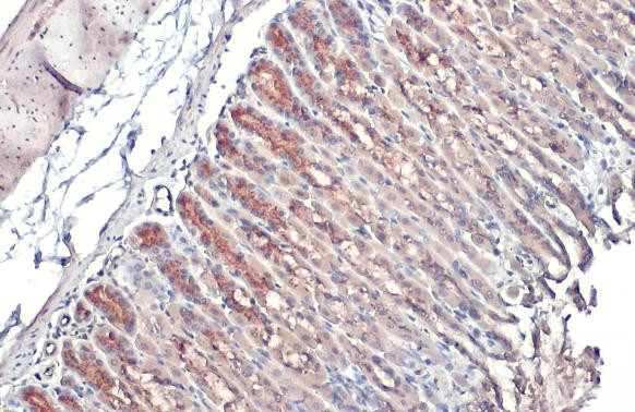 GALNT3 Antibody in Immunohistochemistry (Paraffin) (IHC (P))