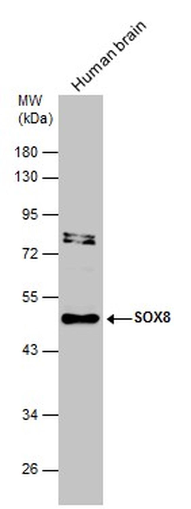 SOX8 Antibody in Western Blot (WB)