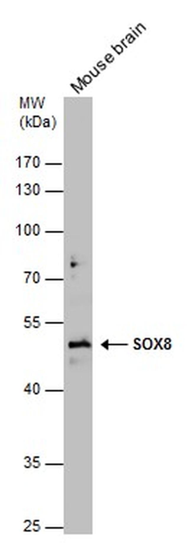 SOX8 Antibody in Western Blot (WB)