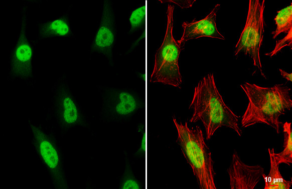 TRF2 Antibody in Immunocytochemistry (ICC/IF)