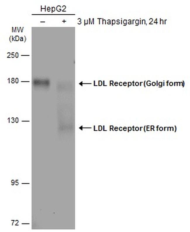 LDL receptor Antibody in Western Blot (WB)