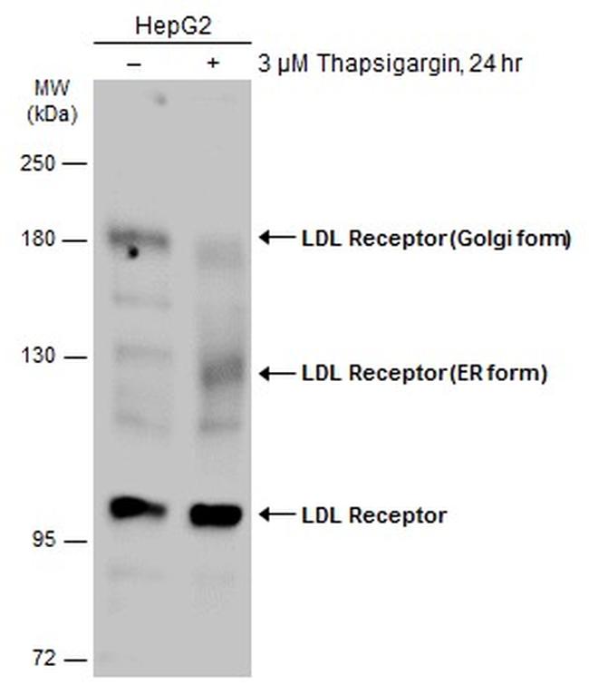 LDL receptor Antibody in Western Blot (WB)