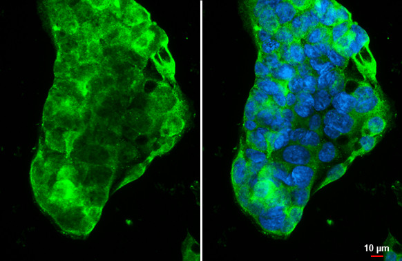 ABCA1 Antibody in Immunocytochemistry (ICC/IF)