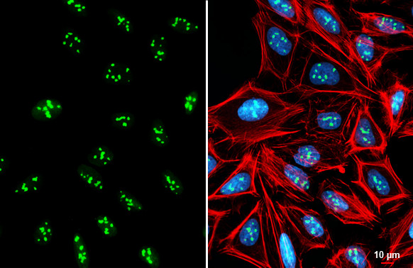 NIFK Antibody in Immunocytochemistry (ICC/IF)