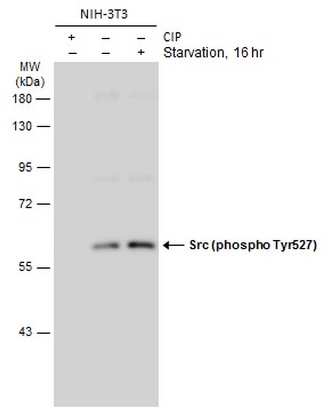 Phospho-SRC (Tyr527) Antibody in Western Blot (WB)