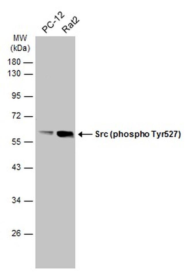 Phospho-SRC (Tyr527) Antibody in Western Blot (WB)