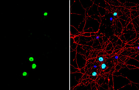 FOXG1 Antibody in Immunocytochemistry (ICC/IF)